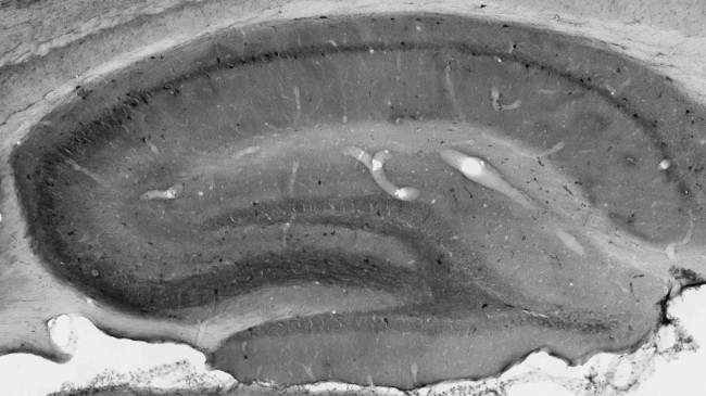 Kv3.3 Potassium Channel Antibody in Immunohistochemistry (Frozen) (IHC (F))