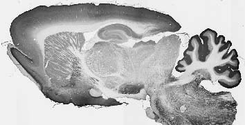 MAP3K12 Antibody in Western Blot (WB)