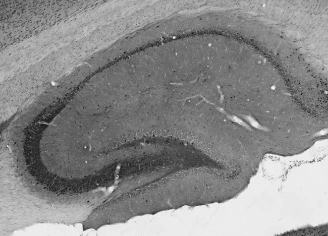 TASK1 Potassium Channel Antibody in Immunohistochemistry (Frozen) (IHC (F))