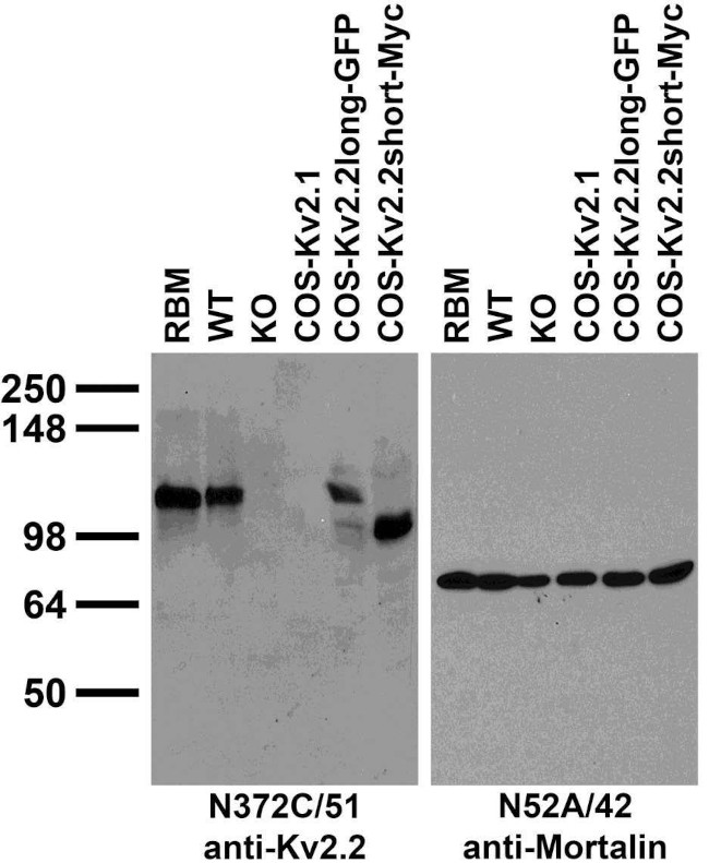 Kv2.2 Potassium Channel Antibody in Immunohistochemistry (Frozen) (IHC (F))