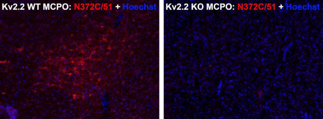 Kv2.2 Potassium Channel Antibody in Immunocytochemistry (ICC/IF)