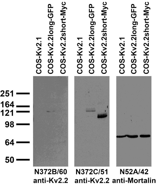 Kv2.2 Potassium Channel Antibody in Immunocytochemistry (ICC/IF)