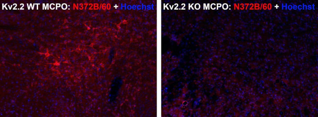 Kv2.2 Potassium Channel Antibody in Immunocytochemistry (ICC/IF)