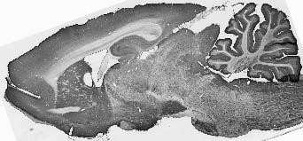MFF Antibody in Immunohistochemistry (Frozen) (IHC (F))