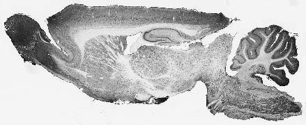 REEP Antibody in Western Blot (WB)