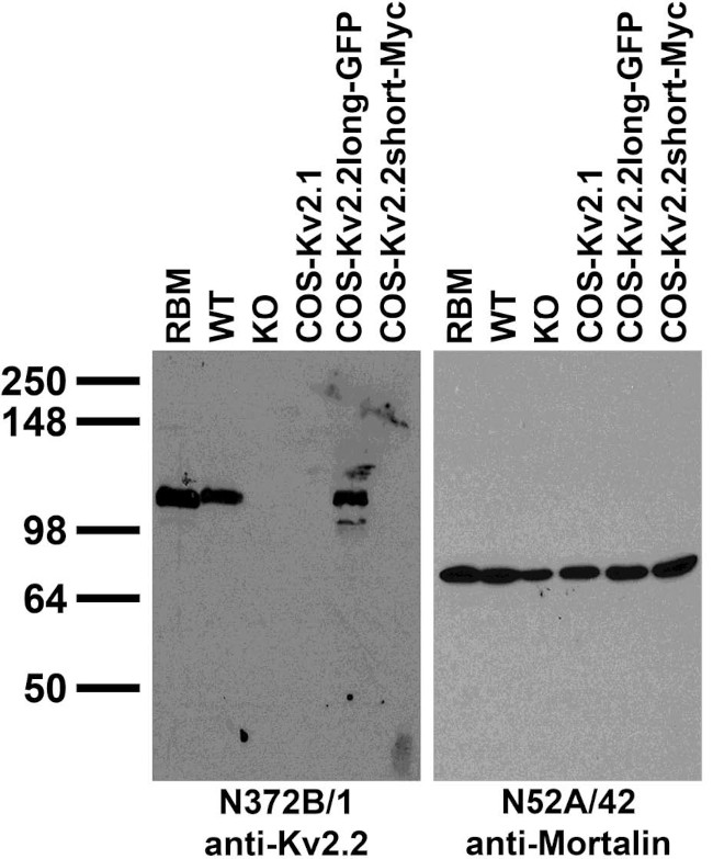 Kv2.2 Potassium Channel Antibody in Immunohistochemistry (Frozen) (IHC (F))