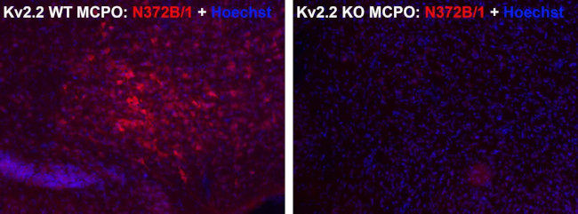 Kv2.2 Potassium Channel Antibody in Immunohistochemistry (Frozen) (IHC (F))