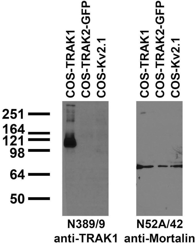 TRAK1 Antibody in Immunocytochemistry (ICC/IF)