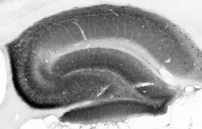 Beta1-Spectrin Antibody in Immunohistochemistry (Frozen) (IHC (F))