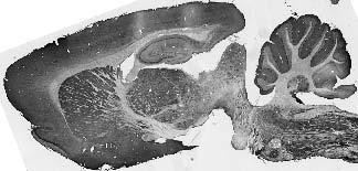 TRAK2 Antibody in Immunohistochemistry (IHC)