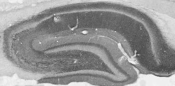Navbeta2 Na+ Channel Antibody in Immunocytochemistry (ICC/IF)
