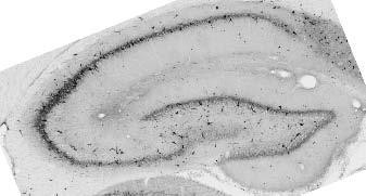 Ankyrin-R Antibody in Western Blot (WB)