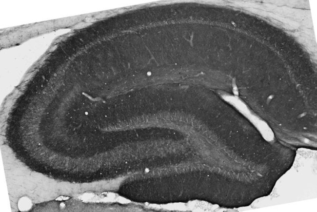 GABA-A-R-Alpha2 Antibody in Immunohistochemistry (Frozen) (IHC (F))