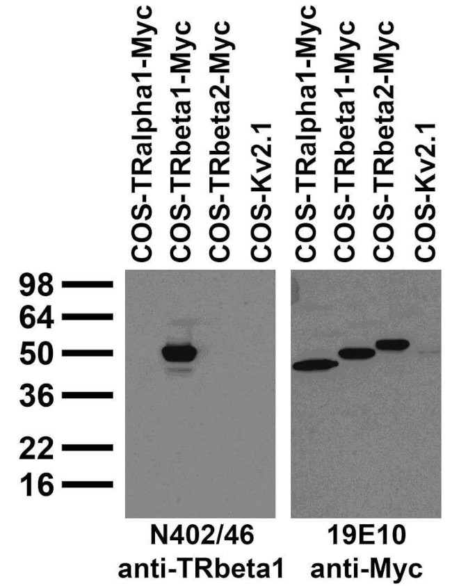 Thyroid Hormone Receptor Beta1 Antibody in Western Blot (WB)