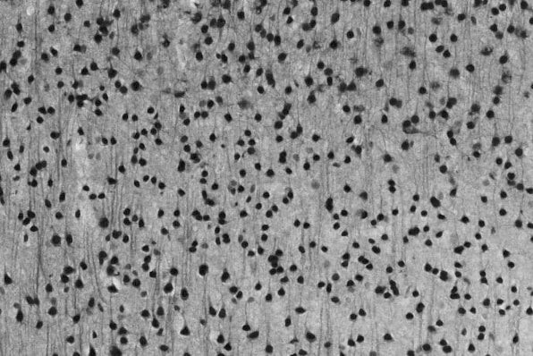 Npas4 Antibody in Immunohistochemistry (Frozen) (IHC (F))