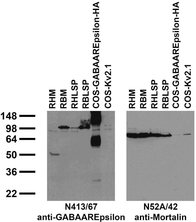 GABA-A-R-Epsilon Antibody in Immunohistochemistry (Frozen) (IHC (F))