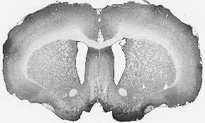 GABA-A-R-Epsilon Antibody in Immunohistochemistry (IHC)