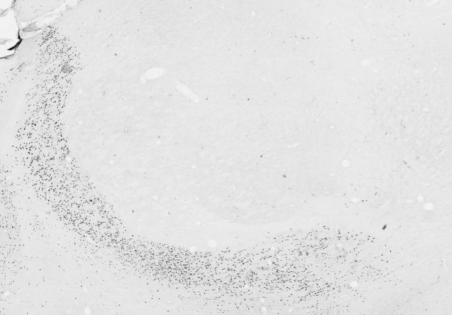 Arx Antibody in Immunohistochemistry (Frozen) (IHC (F))