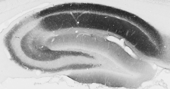 KChIP4 K+ channel Antibody in Immunohistochemistry (Frozen) (IHC (F))