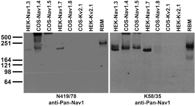 Pan-Nav1 Sodium Channel Antibody in Western Blot (WB)