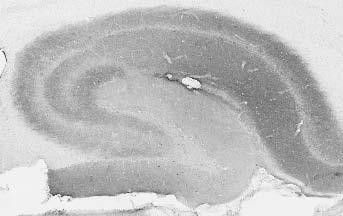 SynDIG4 Antibody in Immunohistochemistry (Frozen) (IHC (F))