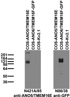 ANO5/TMEM16E Antibody in Western Blot (WB)