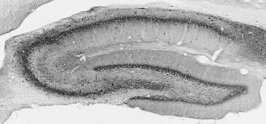 Ankyrin-R/G Antibody in Immunohistochemistry (Frozen) (IHC (F))