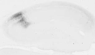 RGS14 Antibody in Immunohistochemistry (Frozen) (IHC (F))