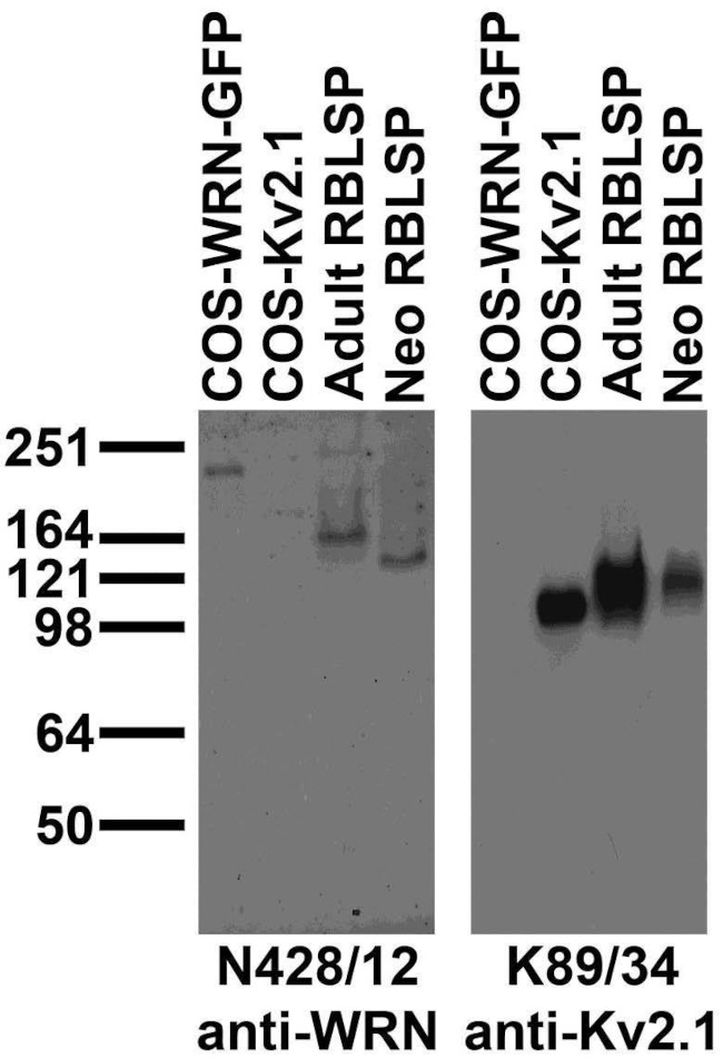 WRN Antibody in Western Blot (WB)