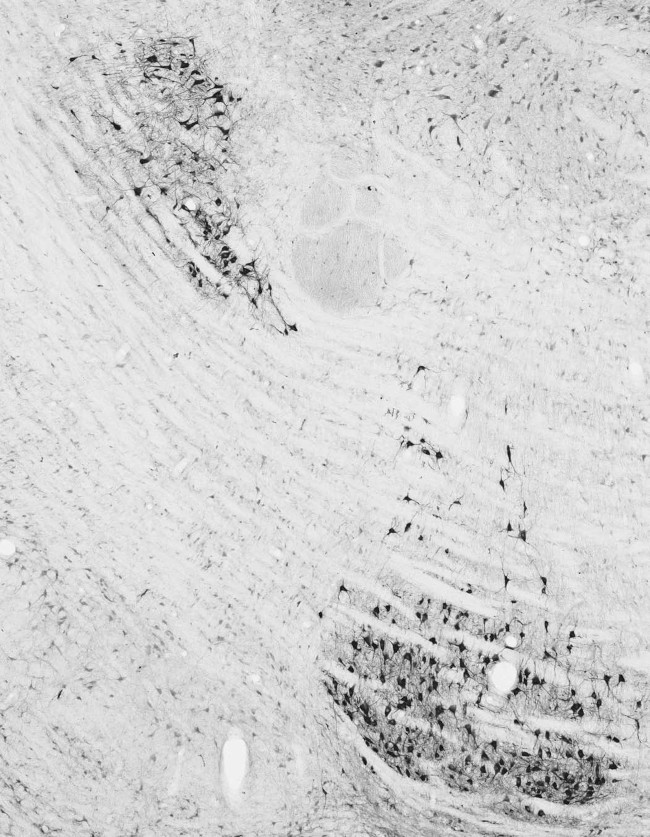 VaChT Antibody in Immunohistochemistry (Frozen) (IHC (F))