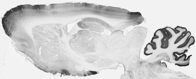 VMAT1 Antibody in Immunohistochemistry (Frozen) (IHC (F))