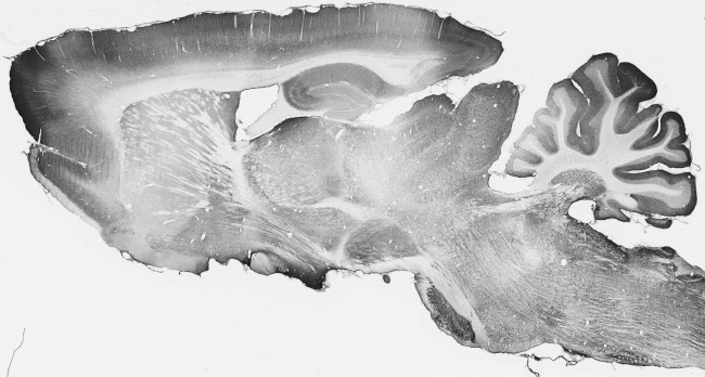 ADAM11 Antibody in Immunohistochemistry (Frozen) (IHC (F))