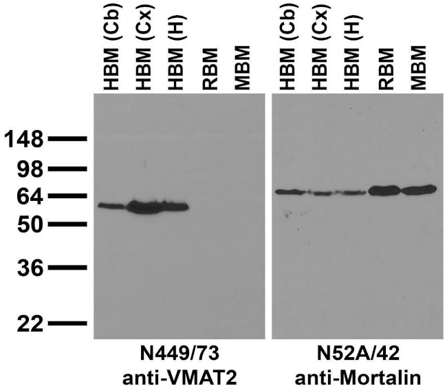 Slc18a2/VMAT2 Antibody in Western Blot (WB)