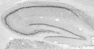 Celf4/Brunol4 Antibody in Immunohistochemistry (Frozen) (IHC (F))