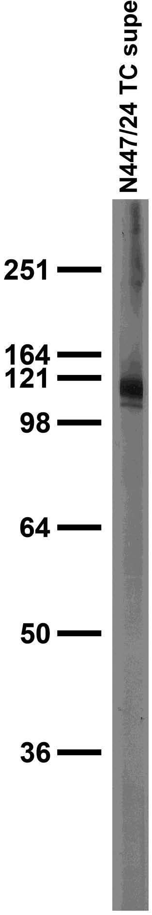Kv11.3 Potassium Channel Antibody in Western Blot (WB)