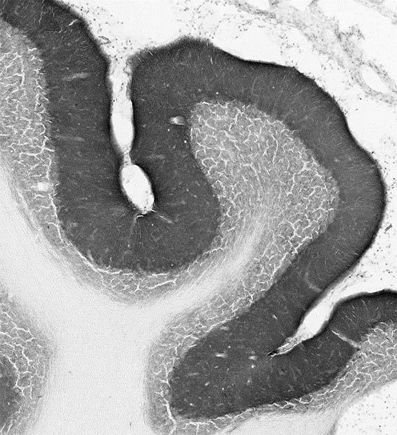 Gephyrin Antibody in Immunohistochemistry (Frozen) (IHC (F))