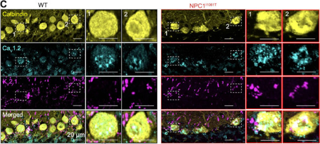 CALB1/calbindin Antibody in Immunohistochemistry (Frozen) (IHC (F))