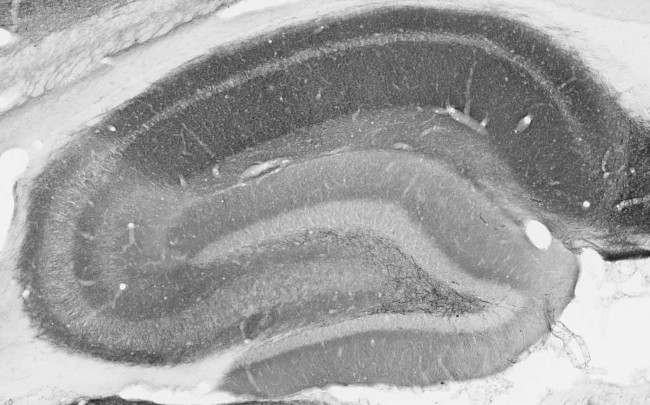 Homer1 Antibody in Immunohistochemistry (Frozen) (IHC (F))