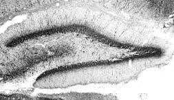 Parvalbumin Antibody in Immunohistochemistry (Frozen) (IHC (F))
