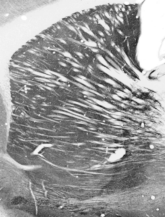 VGAT Antibody in Immunohistochemistry (Frozen) (IHC (F))