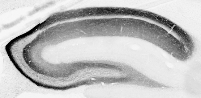 NPY2R Antibody in Immunohistochemistry (Frozen) (IHC (F))