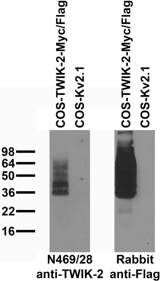 TWIK-2 Antibody in Western Blot (WB)