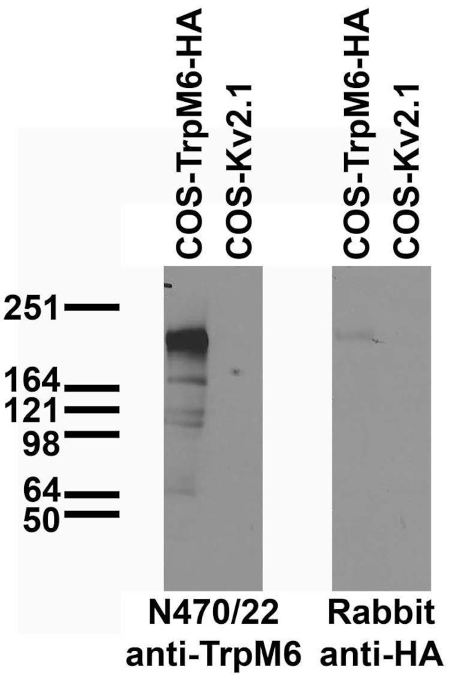 TrpM6 Antibody in Western Blot (WB)
