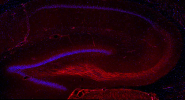 BDNF Antibody in Immunohistochemistry (Frozen) (IHC (F))