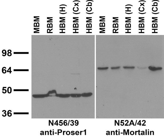 Proser1 Antibody in Western Blot (WB)