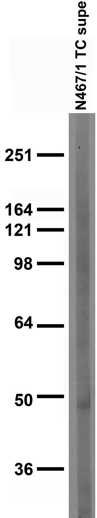TRESK Antibody in Western Blot (WB)