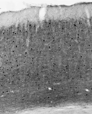 Parvalbumin Antibody in Immunohistochemistry (Frozen) (IHC (F))