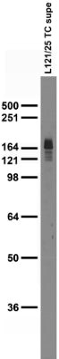 nNOS/NOS1 Antibody in Western Blot (WB)