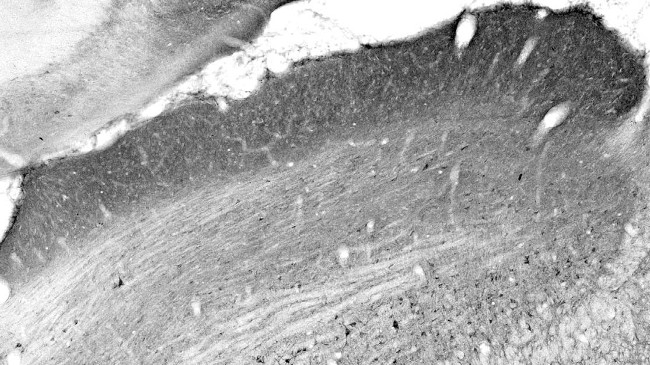 Collybistin Antibody in Immunohistochemistry (Frozen) (IHC (F))