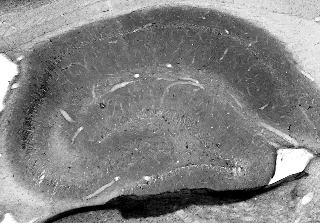 GABA-A-R-Gamma2L/S Antibody in Immunohistochemistry (Frozen) (IHC (F))